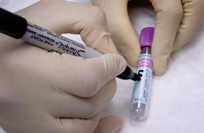Coronavirus: No se registran nuevos casos en la provincia