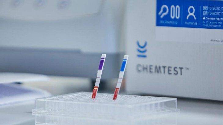 Científicos argentinos crearon un nuevo test de diagnóstico