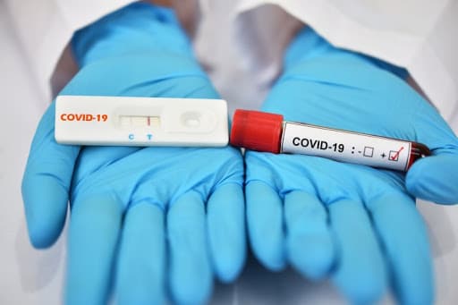 Se registraron 47 nuevos casos de Covid-19 en la Provincia
