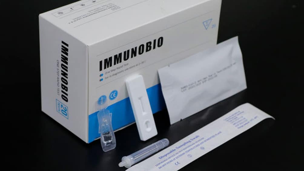 Se venderá en farmacias un test rápido para detectar coronavirus